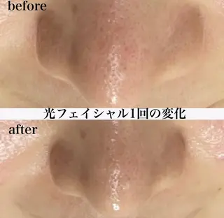 RinRin 松本店のエステ・リラクイメージ