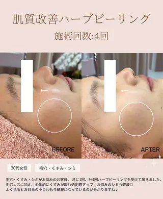 肌質改善専門サロン Bellmi/心斎橋のエステ・リラクイメージ