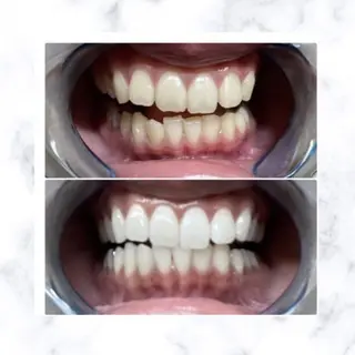 ホワイトニング専門店 LCS 銀座店 峰岡のその他イメージ