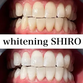 福岡ホワイトニング SHIRO天神店のエステ・リラクイメージ
