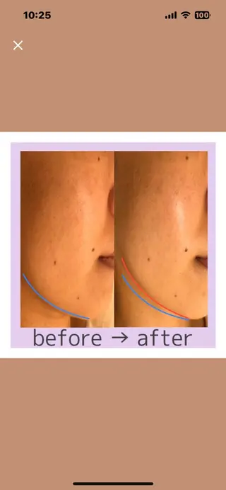 エステ POLA 梅田のエステ・リラクイメージ