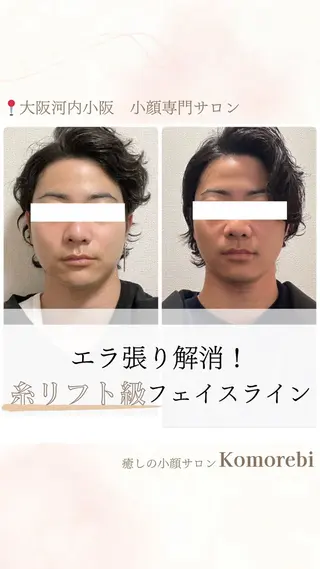 営業電話❌小顔サロン Komorebiのエステ・リラクイメージ