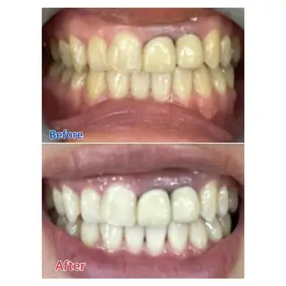 M渋谷店所属・M渋谷 ホワイトニングのエステ・リラクイメージ