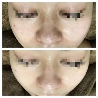 La beauté et santé岡崎店所属・望月 はるかのエステ・リラクイメージ