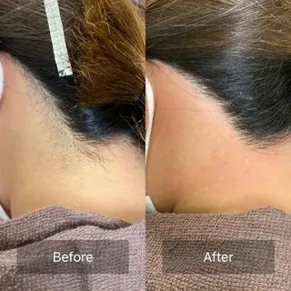 産毛専門店 Bittoのエステ・リラクイメージ