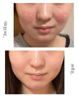 脱毛・肌質改善サロン Linoのエステ・リラクイメージ