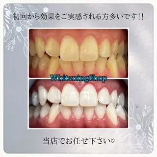 ホワイトニング ショップ吉祥寺店のエステ・リラクイメージ