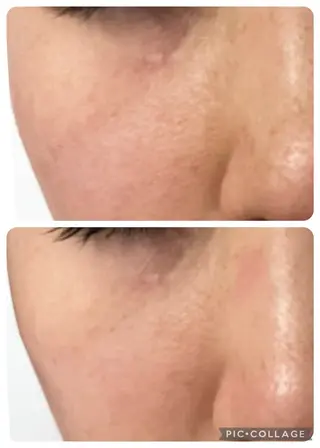 愛維美水光美肌専門店所属・愛維美水光美肌専門店 メンズレディースokのエステ・リラクイメージ