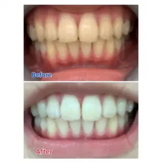 M渋谷店所属・Ｍ渋谷 ホワイトニングのエステ・リラクイメージ