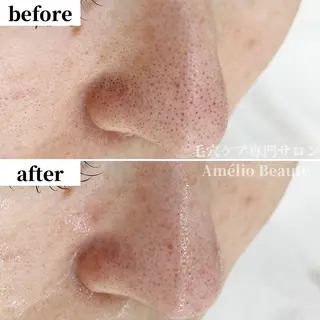 毛穴ケア専門サロン Amélio Beauté所属・毛穴ケア専門サロン アメリオボーテのその他イメージ