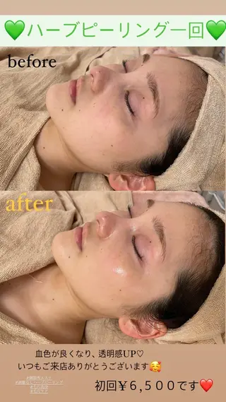 メンズ Salon de Lino 御器所のエステ・リラクイメージ