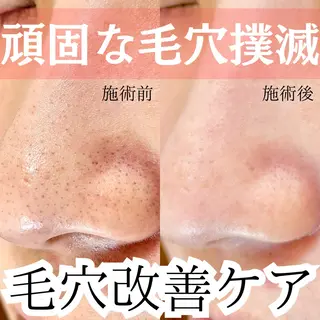 Ella〜eye&beauty〜所属・Ella【エラ】 毛穴専門サロンのエステ・リラクイメージ