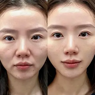 ネイル aliaハイフ&水光ジェットサロン所属・aliaハーブ水光店 エステティシャン募集のエステ・リラクイメージ