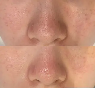 DeI'm   名古屋栄所属・小林 玲菜のエステ・リラクイメージ