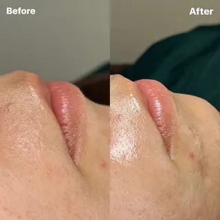 Eyebrow salon 　Naiden所属・Naiden/ ゆりっぺの眉毛・アイブロウイメージ