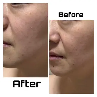 【敏感肌管理×小顔サロン】Belle orchid所属・敏感肌×小顔サロン 玲央奈のエステ・リラクイメージ