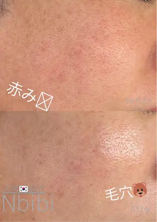 韓国🇰🇷価格 サロン_Nbibiのエステ・リラクイメージ