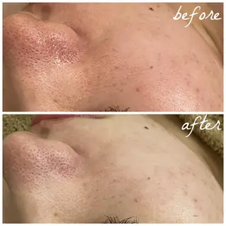 メンズ メナード岐阜市茜部 杉浦のエステ・リラクイメージ