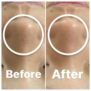 肌質改善・小顔サロン 20代店長RINNAのエステ・リラクイメージ