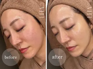 ＆epi 【エステ】のエステ・リラクイメージ