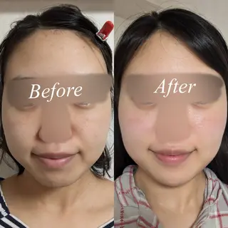 肌質改善サロン🌕 ⠀【ルーナピエナ】のエステ・リラクイメージ