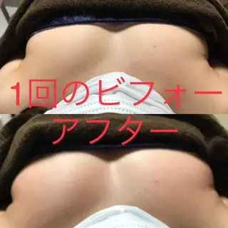 首・肩こり専門リンパ ケアサロンSENKAのエステ・リラクイメージ