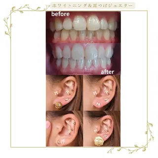 coco whitening＆Beauty所属・阿部 香織のエステ・リラクイメージ