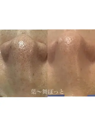 うえつま ふみえのエステ・リラクイメージ