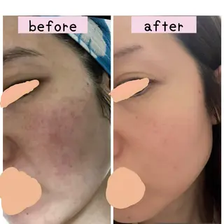 毛穴・リンパ・肌ケア サロン スリールのエステ・リラクイメージ