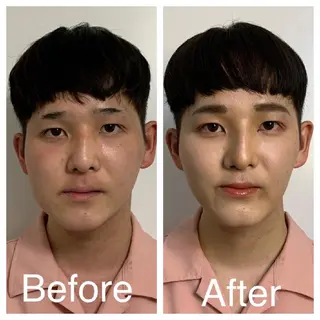 メンズ 医療提携Ruby所属・医療提携Ruby小顔 ハーブピーリングのその他イメージ