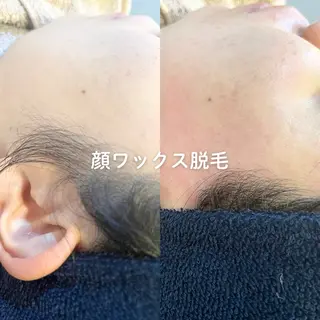 EST BEAUTY所属・顔ワックス脱毛/ ハーブピーリングのエステ・リラクイメージ