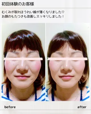小顔矯正& 慢性肩こり腰痛改善店のエステ・リラクイメージ