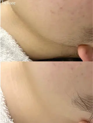 女性専門お顔剃り sunraineのエステ・リラクイメージ