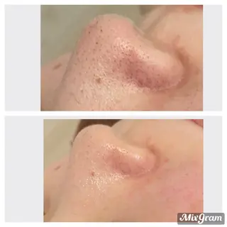 メナードフェイシャルサロン　リンガーデン所属・田中 友佳理のエステ・リラクイメージ