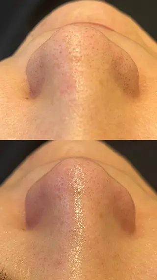 Lilyboo 池袋のエステ・リラクイメージ