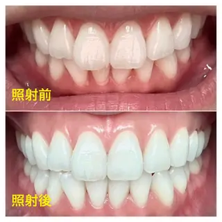 ホワイトニングジム 池袋のその他イメージ