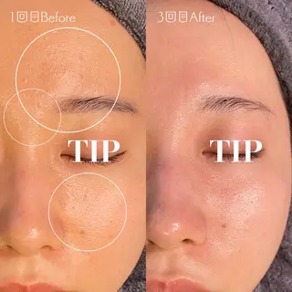 Mau beauty salon所属・Mau (マウ)のエステ・リラクイメージ