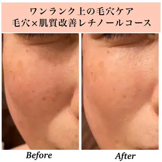 Bellesthe （ベルエステ）のエステ・リラクイメージ