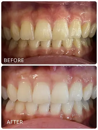 ホワイトニングサロン ラウレアのその他イメージ