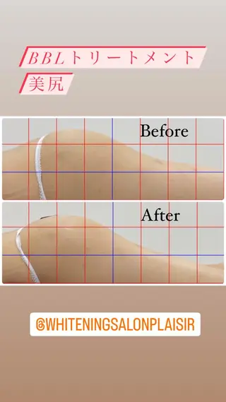 ホワイトニングサロン プレジールのエステ・リラクイメージ