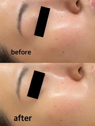 肌ケア＆毛穴洗浄 Cheriのエステ・リラクイメージ