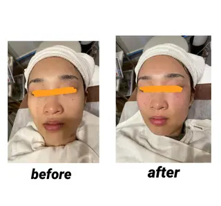 DeI'm   名古屋栄所属・小林 玲菜のエステ・リラクイメージ