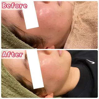 ハーブピーリング専門 muro.のエステ・リラクイメージ