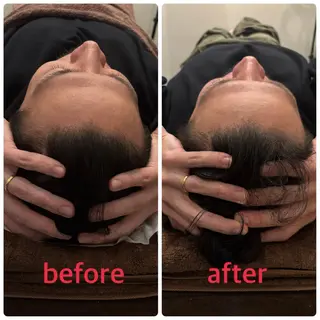 小林整骨院本町 美容鍼roomのエステ・リラクイメージ