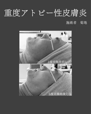 BLOSSOM 菊地のエステ・リラクイメージ