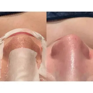 パルティール渋谷店所属・完全個室🌿✨ 痩身・小顔・美肌💖のエステ・リラクイメージ