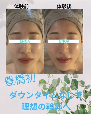 ENOA所属・コルギ/全身リンパ saoriのエステ・リラクイメージ