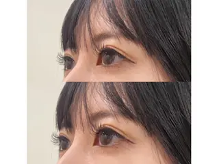 マツエク・マツパ アンジェリカミッシェルセンター北店所属・Nakao Harukaのマツエク・マツパデザイン