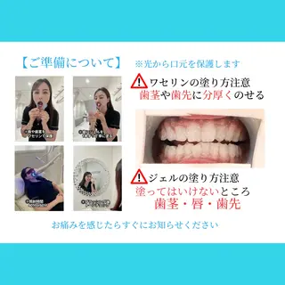 ホワイトニング ショップ多摩店のその他イメージ