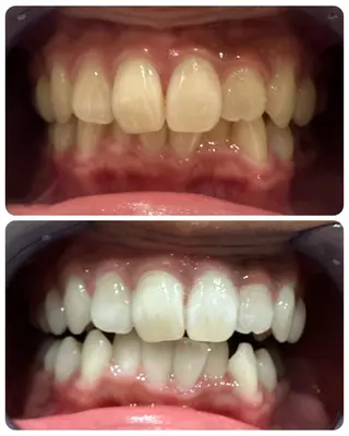 The Salon 脱毛&眉毛スタイリング&セルフホワイトニング所属・The Salon 脱毛&眉毛の眉毛・アイブロウイメージ